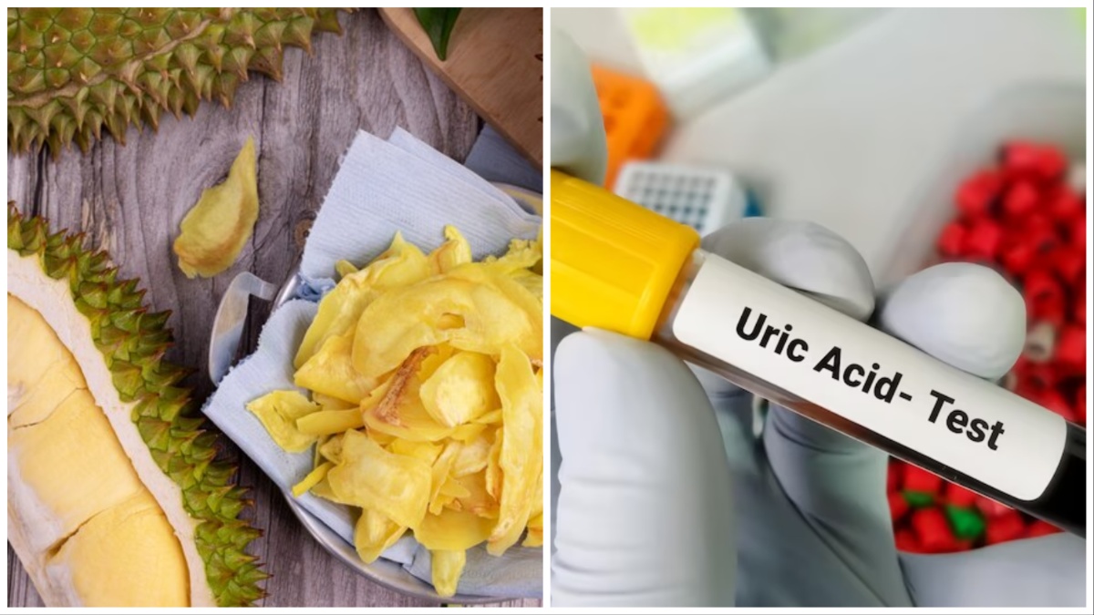 यूरिक एसिड को घटाने के लिए क्या खाना चाहिए | What is the best home remedy for high uric acid