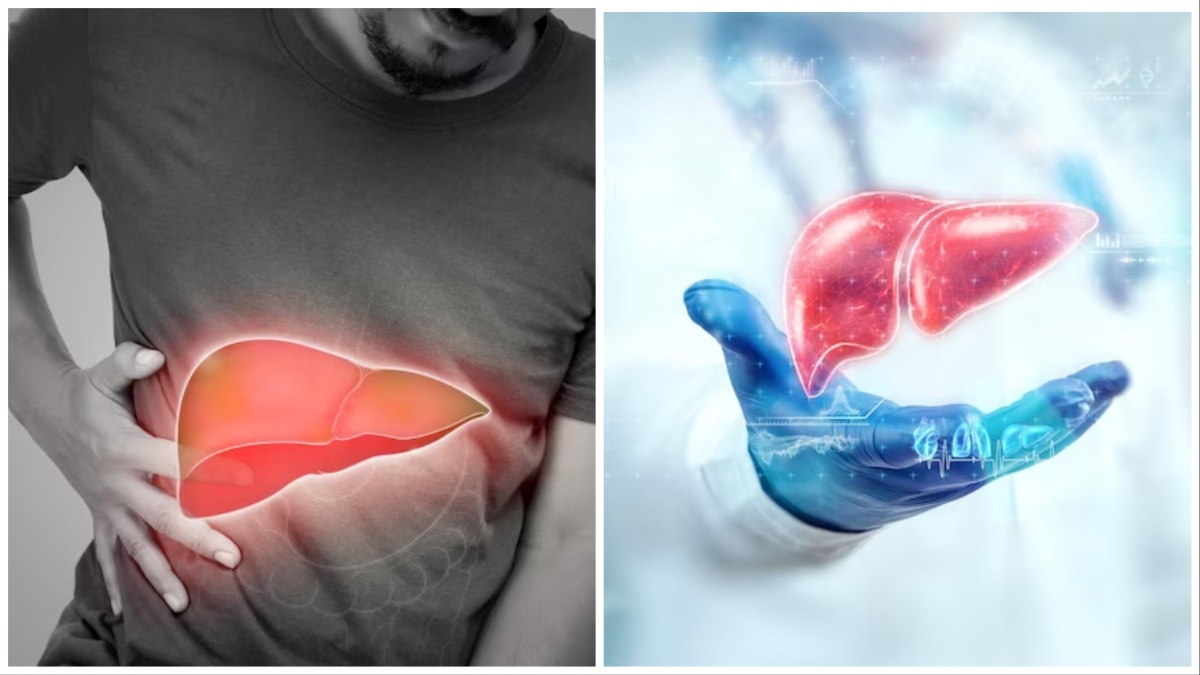 लिवर के मरीज को क्या नहीं खाना चाहिए What foods are bad for liver in