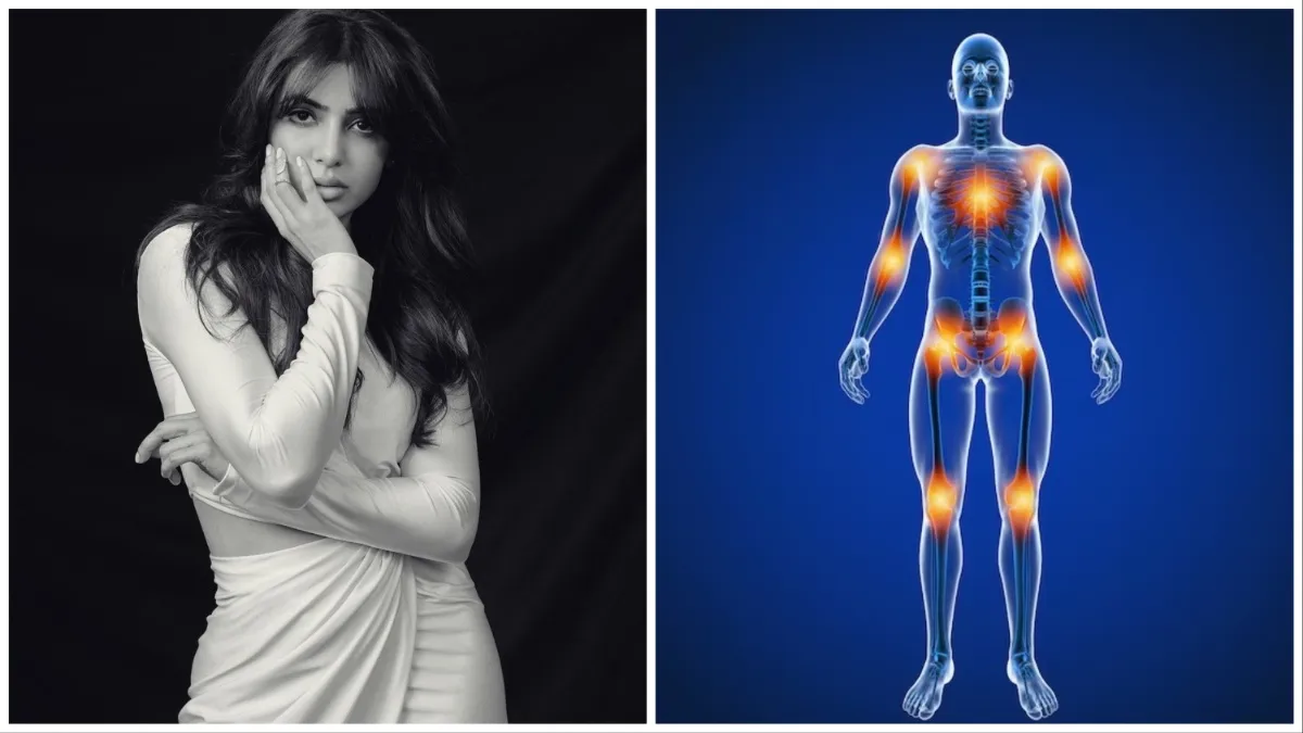 Myositis से जूझ रही हैं समांथा, जानिए इस दुर्लभ बीमारी के लक्षण, कारण और इलाज What is myositis- India TV Hindi