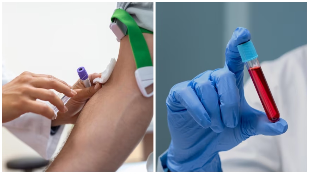 ब्लीडिंग डिसऑर्डर क्या होता है | What is bleeding disorder in hindi ब्लीडिंग डिसऑर्डर क्या होता है | What is bleeding disorder in hindi