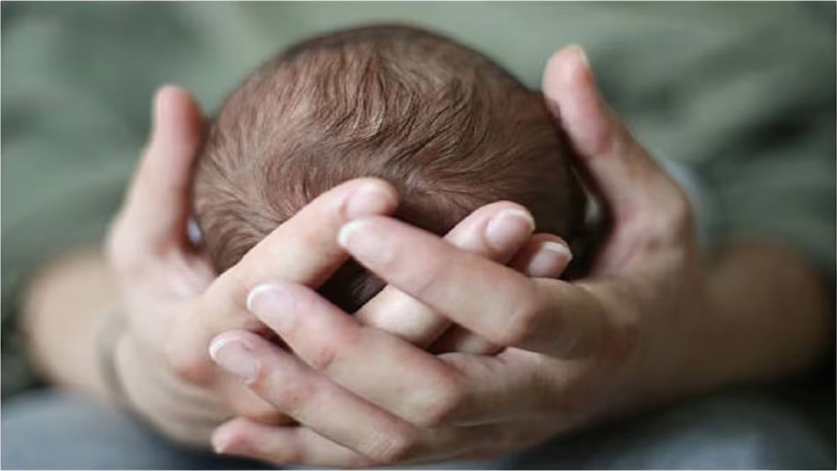 पीलीभीत: अस्पताल में पैदा हुआ मछली जैसा दिखने वाला बच्चा, देखने के लिए लग गया तांता l Pilibhit A baby looking like a fish was born in the hospital
