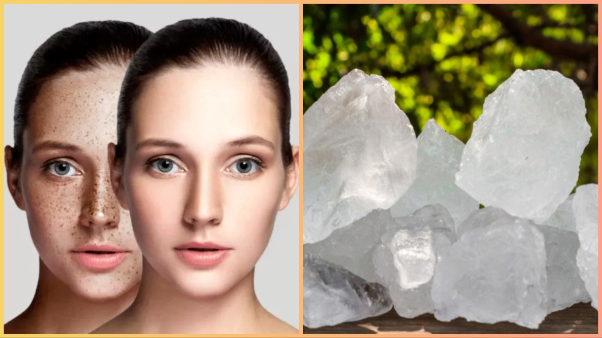 फिटकरी से कालापन कैसे दूर करें: जानें 3 तरीके | How to use Alum for skin pigmentation in hindi