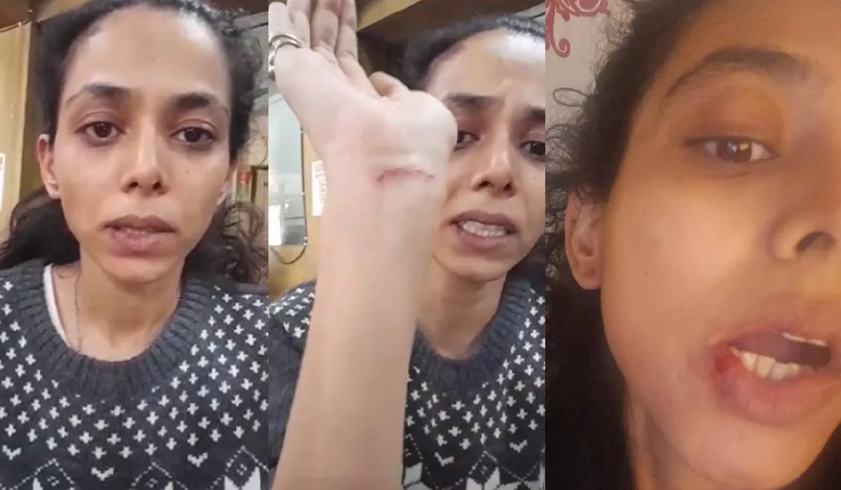 CID एक्ट्रेस वैष्णवी धनराज के साथ हुई मारपीट, कुछ घंटे पहले वीडियो बनाकर मांगी मदद Vaishnavi Dhanraj, CID- India TV Hindi