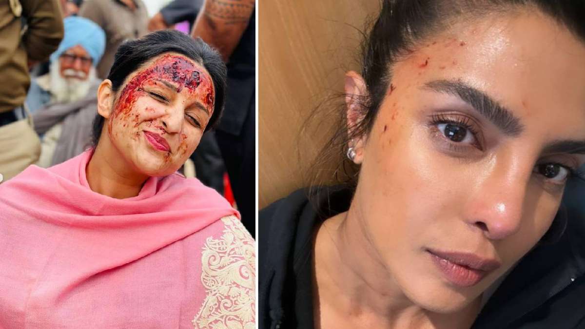 प्रियंका चोपड़ा शूटिंग के वक्त हुईं घायल, तो बहन परिणीति की ‘खून से लथपथ’ ये तस्वीर होने लगी वायरल