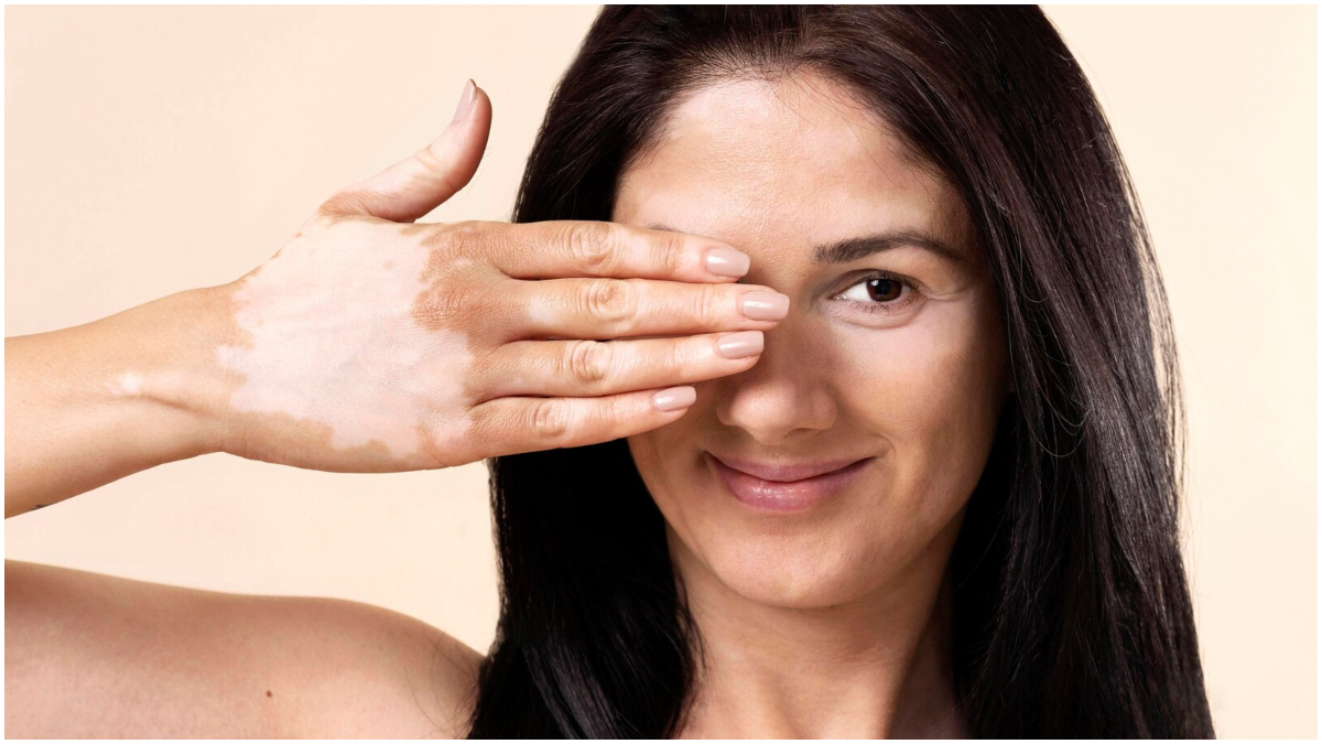 Attention Such symptoms can appear on the face due to deficiency of Vitamin B12