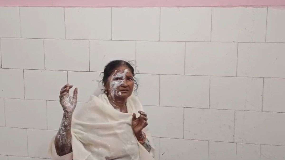 शादी समारोह में पैर फिसला और गरम घी की कढ़ाई में गिरी महिला, अस्पताल में भर्ती