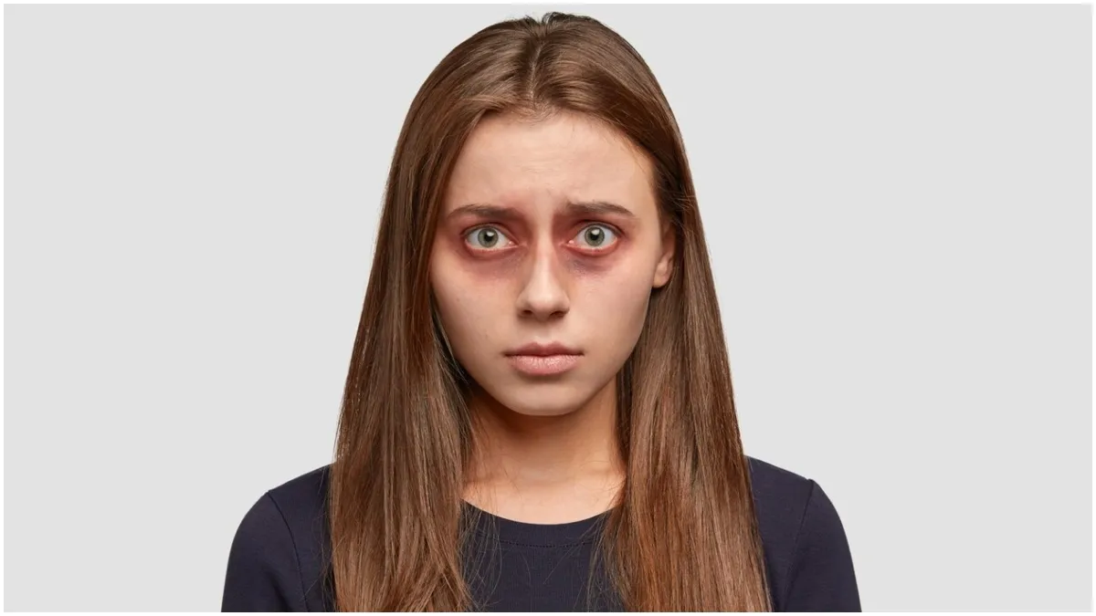 आंखों की सेहत पर वार कर सकती है बढ़ती ठंड, बचने के लिए थाम लीजिए आयुर्वेद का हाथ आंखों को नुकसान पहुंचा सकती है ठंड- India TV Hindi