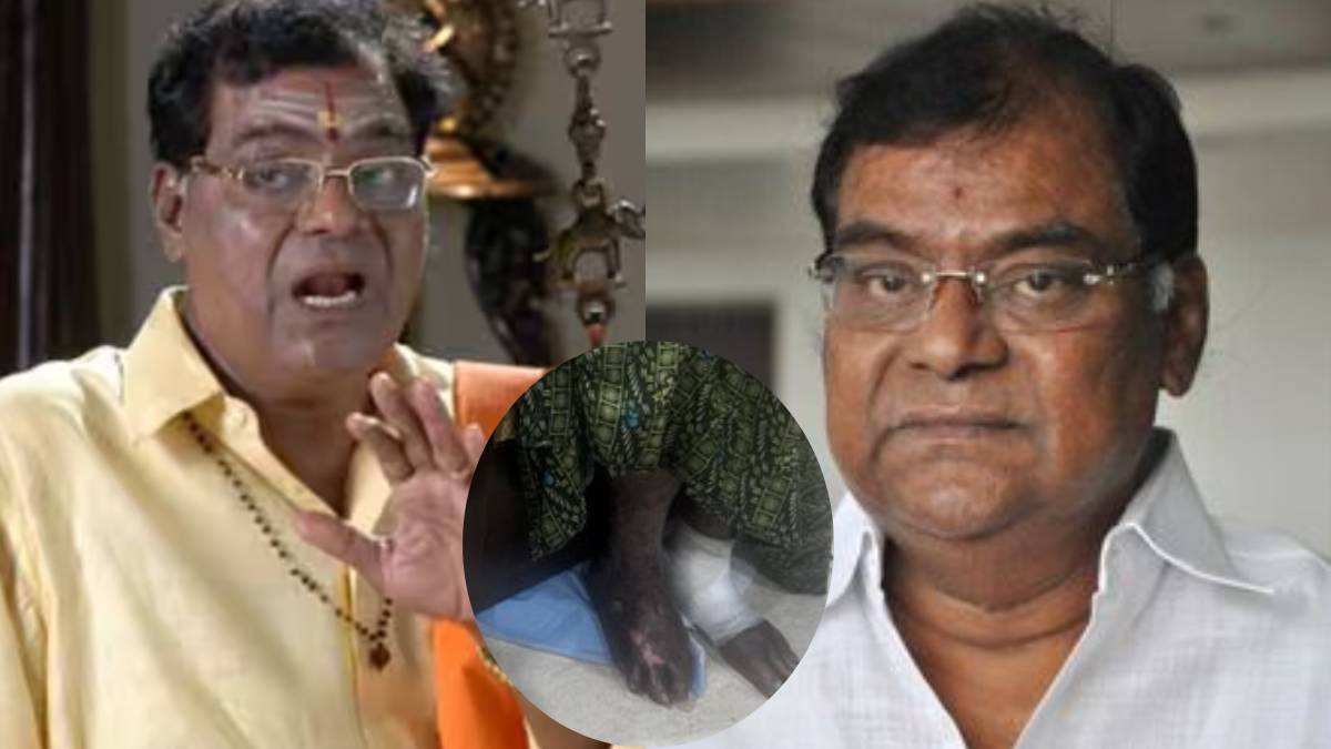 घटा वजन और जख्मी पैर… कभी साउथ सिनेमा पर राज करता था ये एक्टर, अब हो गई ऐसी हालत