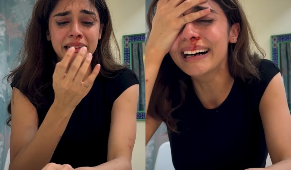 एक्ट्रेस की नाक से बहता खून देख फैंस हुए परेशान, रोते-बिलखते हुआ बुरा हाल