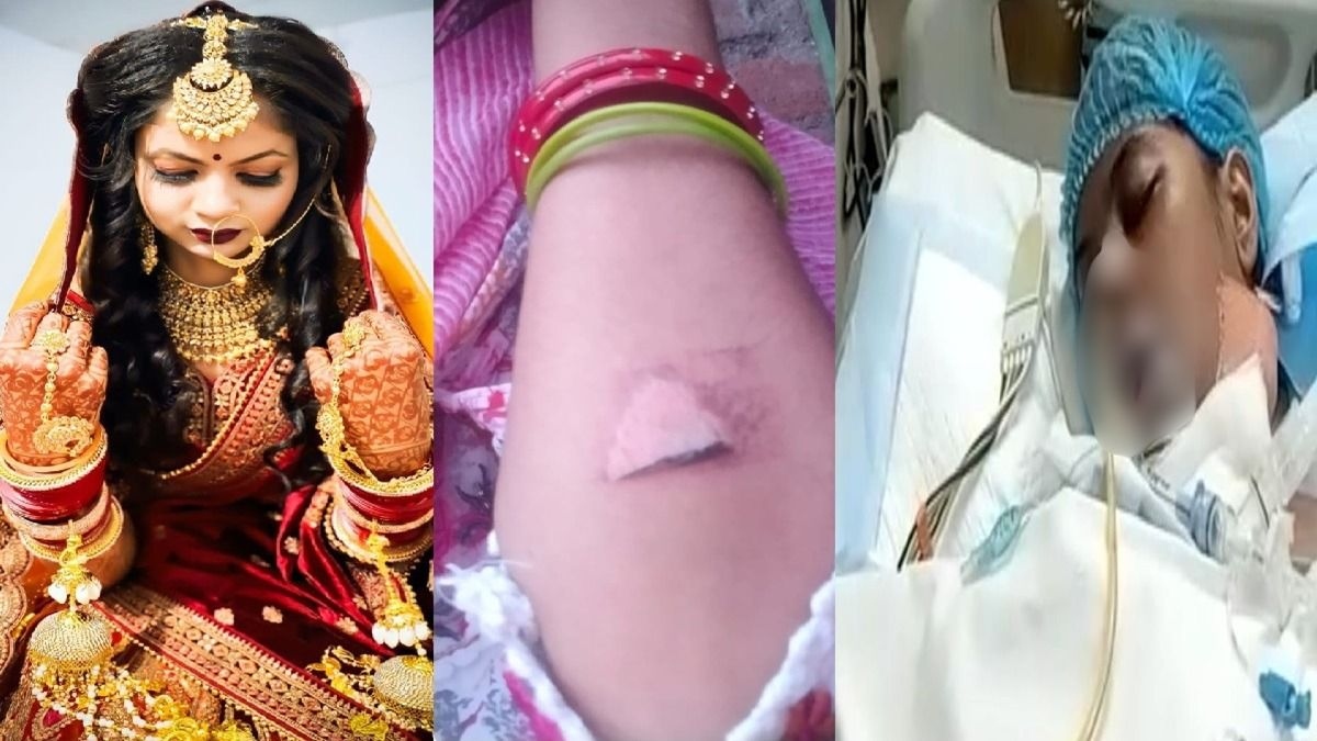 दहेज में गाड़ी की ऐसी डिमांड… बहू की गर्म चिमटे से पिटाई, कोल्ड ड्रिंक में दिया जहर, मौत के मुंह से जूझ रही पीड़िता