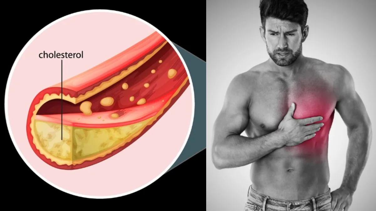 कहीं शरीर में बढ़ तो नहीं रहा है कोलेस्ट्रॉल का स्तर, किन लक्षणों के दिखाई देने पर हो जाना चाहिए सावधान? हाई कोलेस्ट्रॉल- India TV Hindi