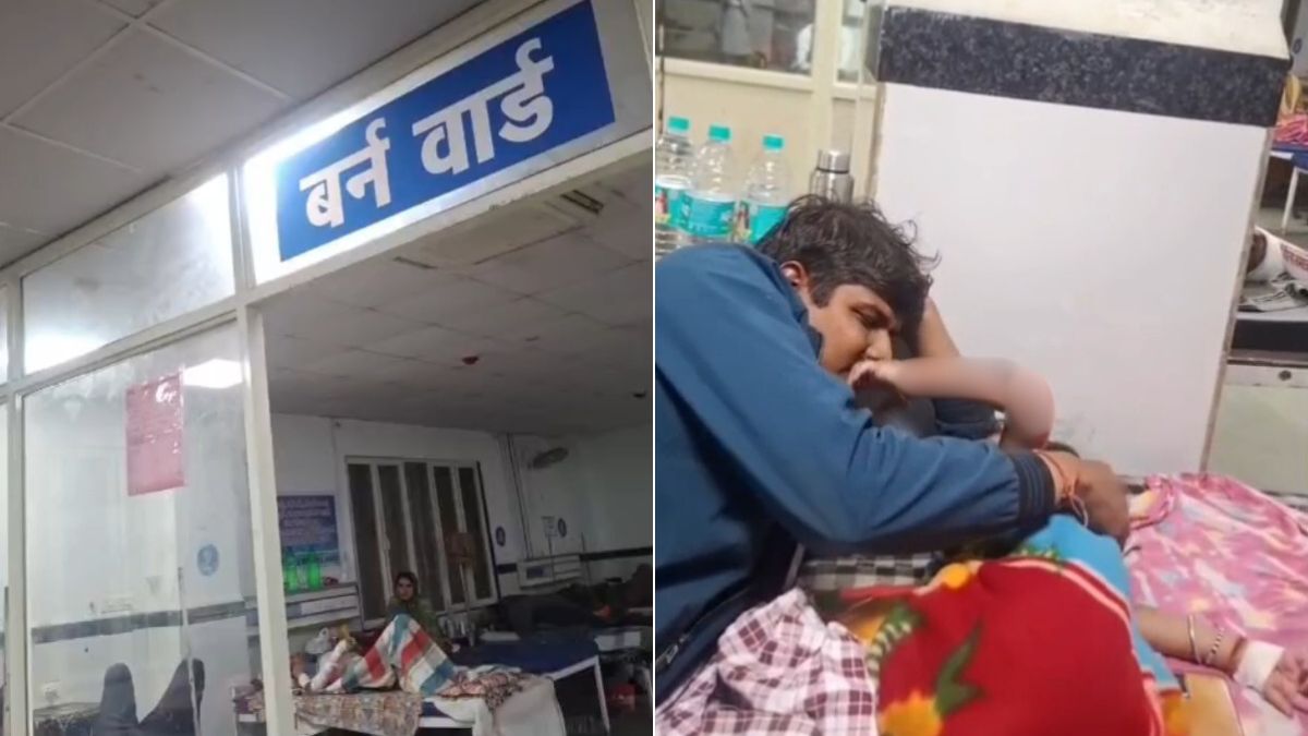 बागेश्वर धाम में समोसे की दुकान पर खौलते तेल में गिरा 2 साल का मासूम, बचाने दौड़ी दादी भी जलीं बागेश्वर धाम में समोसे की दुकान पर खौलते तेल में गिरा 2 साल का मासूम, बचाने दौड़ी दादी भी जलीं