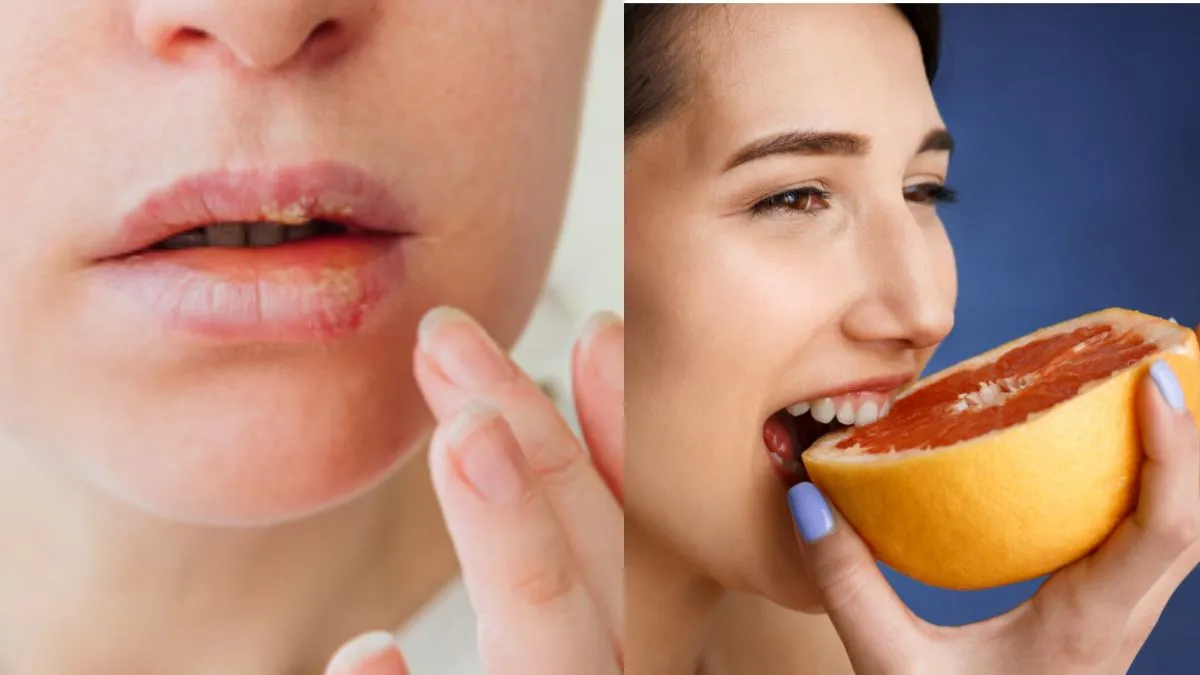 ⁠किस विटामिन की कमी से फटते हैं होठ- India TV Hindi