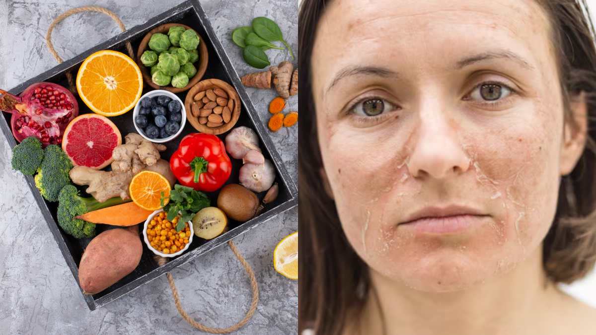 रूखी फटी त्वचा वालों को सर्दियों में जरूर खाने चाहिए ये फल और सब्जियां, डॉक्टर ने बताया नेचुरली ग्लो करने लगेगी स्किन