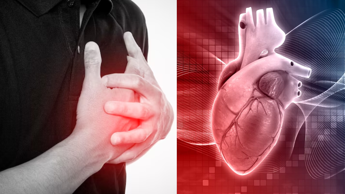 हार्ट अटैक आने पर कितने प्रतिशत रहता है बचने का चांस? डॉक्टर ने बताया फौरन करें ये काम, बच जाएगी मरीज की जान