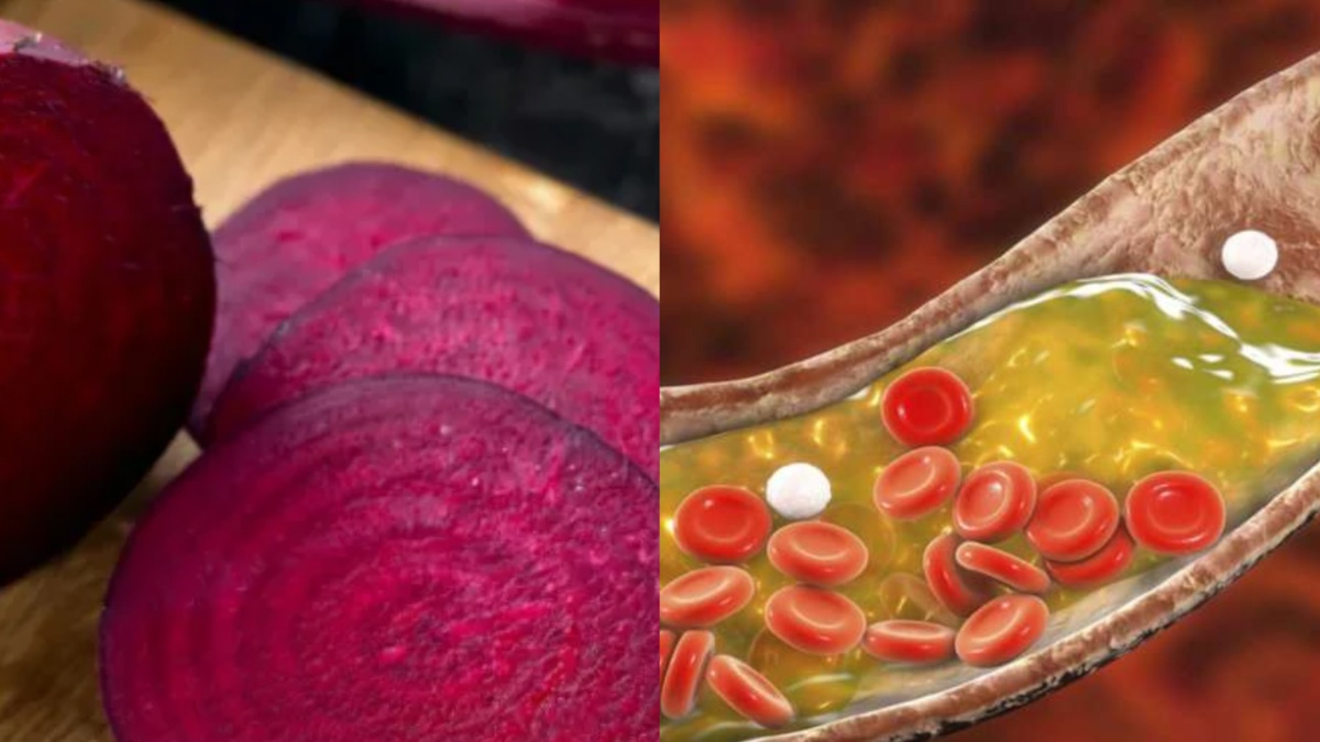 शरीर में बढ़ गया है बैड कोलेस्ट्रॉल तो डाइट में शामिल करें ये 1 चीज, नसों में चिपका फैट लगेगा गलने