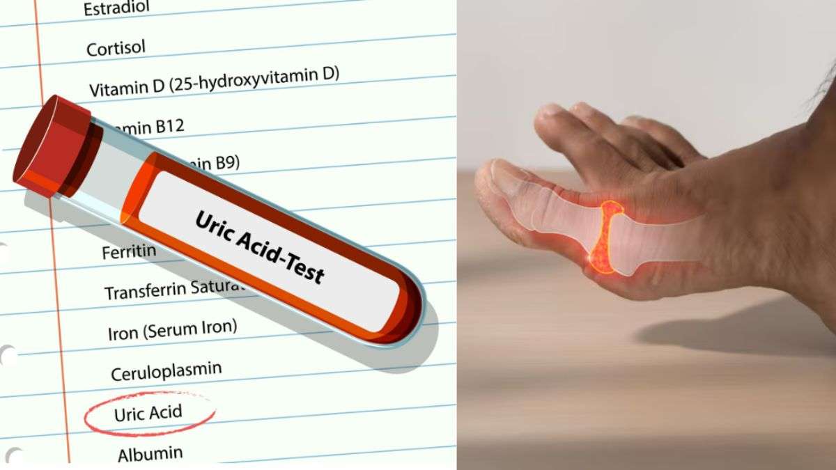 यूरिक एसिड बढ़ने पर शरीर में दिखते हैं ये लक्षण, जान लें कंट्रोल करने के उपाय
