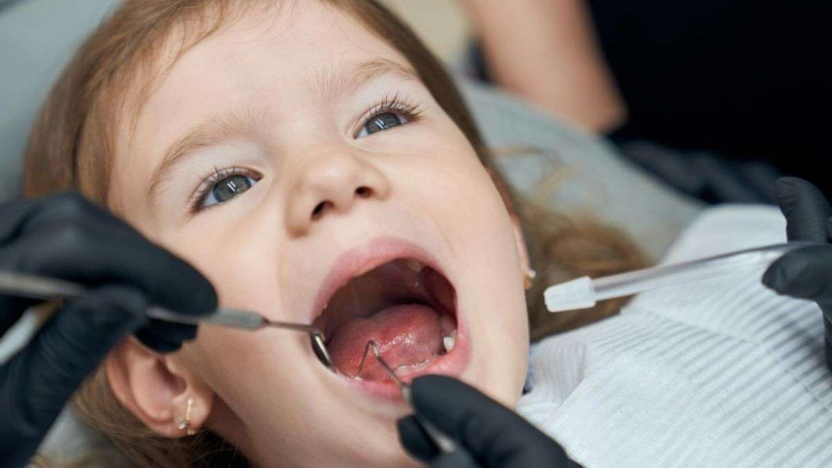 बच्चों में कैविटी होने से रोकने के लिए क्या उपाय करने चाहिए, दांतों को सड़न से बचाने का तरीका बच्चों में कैविटी होने से रोकने के लिए क्या उपाय करने चाहिए, दांतों को सड़न से बचाने का तरीका