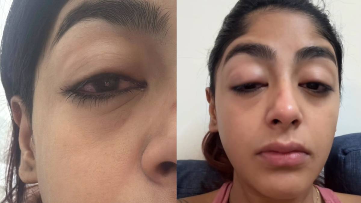 एक्ट्रेस संग भरे क्लब में हुई मारपीट, टूटे दांत-सूजी आंखें और चेहरा, वीडियो वायरल