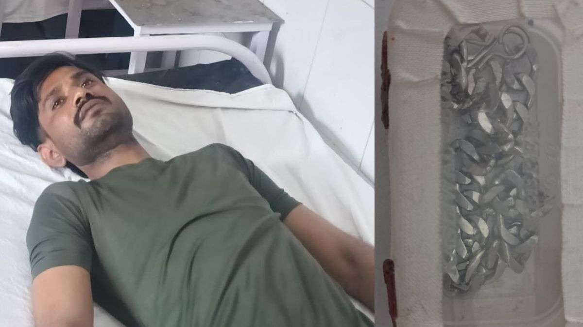 यूपी पुलिस ने ‘मलद्वार’ से निकलवा ली चांदी, चोरी के बाद निगल लिया था चोर; खिलानी पड़ी थी दवा