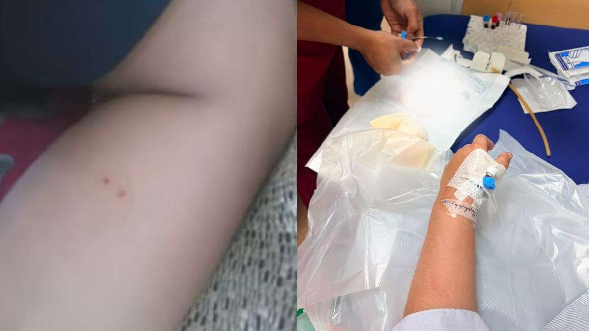 प्राइवेट स्कूल के बाथरूम में डेढ़ फुट लंबे सांप ने तीसरी क्लास के स्टूडेंट को काटा! हॉस्पिटल में कराना पड़ा भर्ती