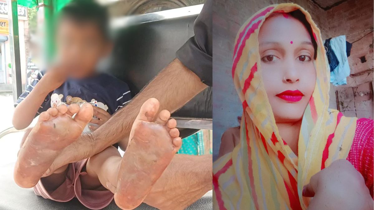 5 रुपये की टॉफी खाने पर तालिबानी सजा, मां ने गर्म चाकू से दागे बेटे के पैर