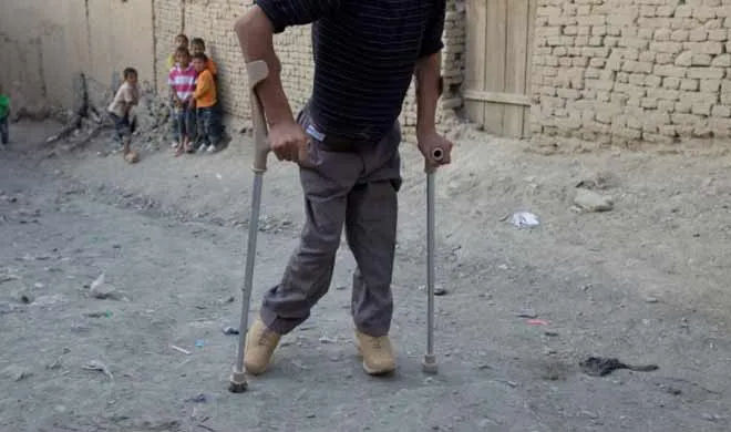 polio case- India TV Hindi