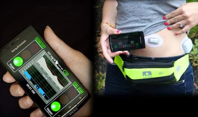 Artificial pancreas- India TV Hindi