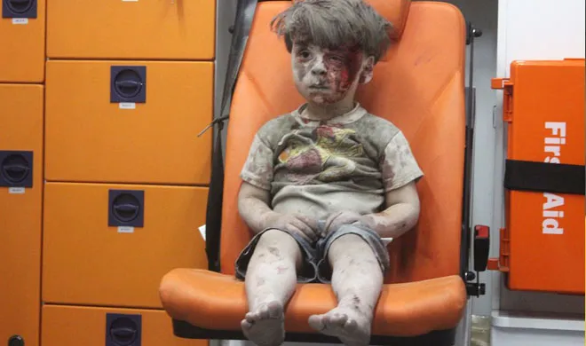 Sirian boy Omran injured in airstrike- India TV Hindi