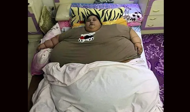 egypt fat lady weight will be surprise you- India TV Hindi