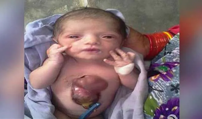 baby born with heart beating outside her chest- India TV Hindi