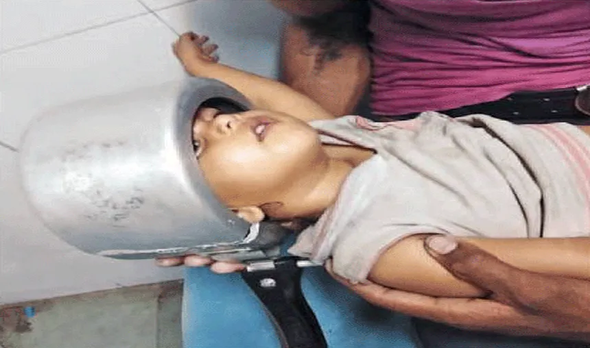 Surat-Child-gets-his-head-stuck-in-pressure-cooker- India TV Hindi