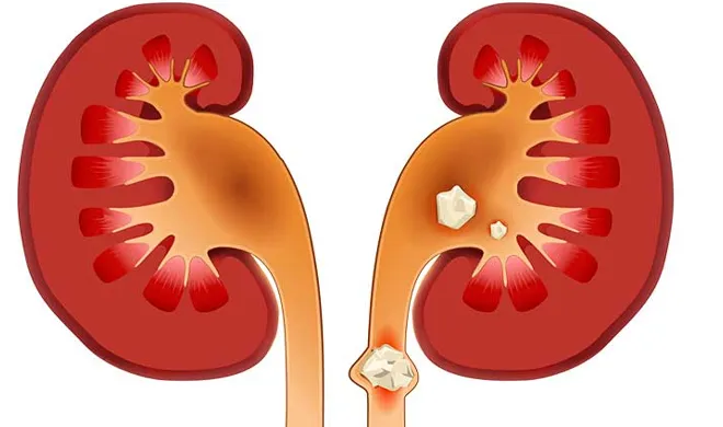 kidney - India TV Hindi