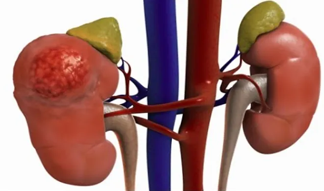 kidney- India TV Hindi
