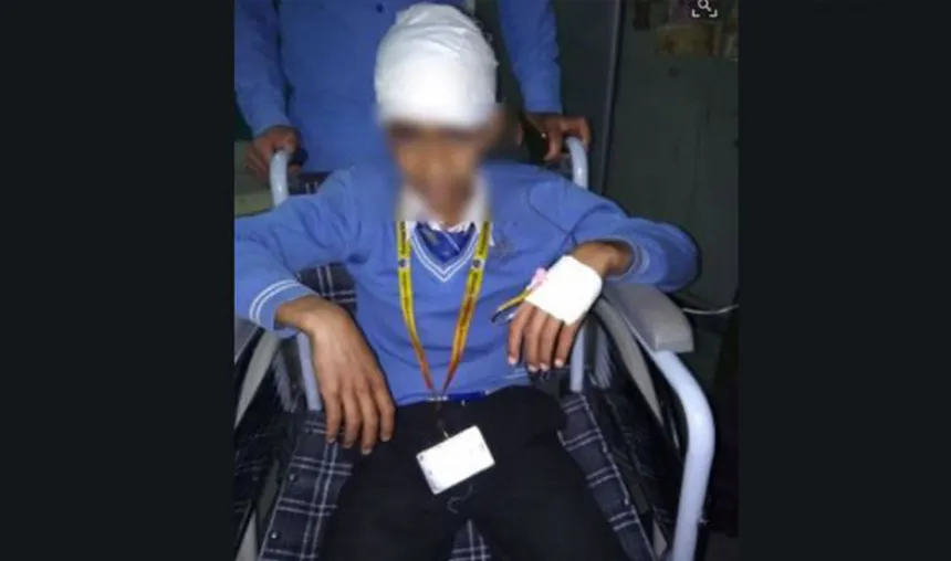 Kashmir: School bus attacked by stone-pelters in Shopian, 2 students injured- India TV Hindi