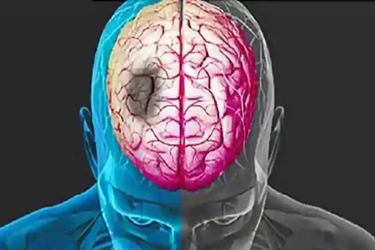 brain stroke- India TV Hindi