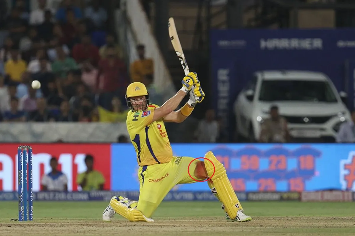 Watson spoke on the innings played with the injured opening in the IPL 2019 final, a little blood ca- India TV Hindi