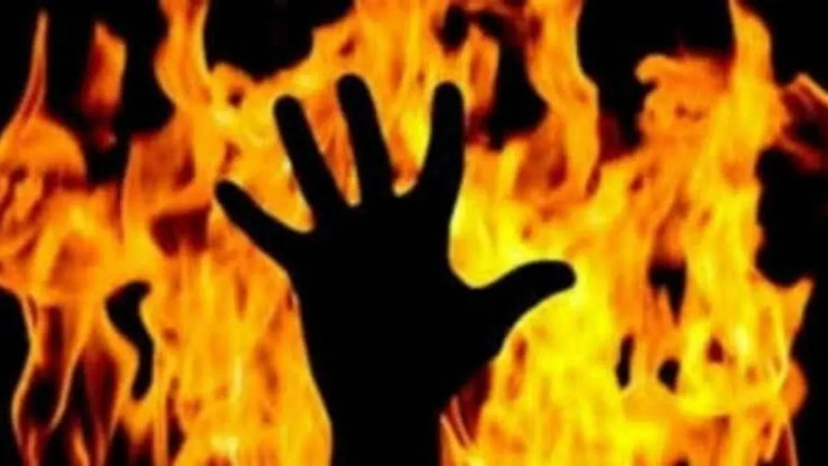 The minor girl who was allegedly set ablaze by a man in...- India TV Hindi