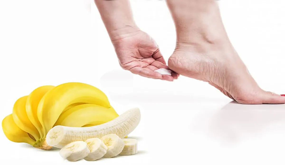 banana for cracked heel- India TV Hindi