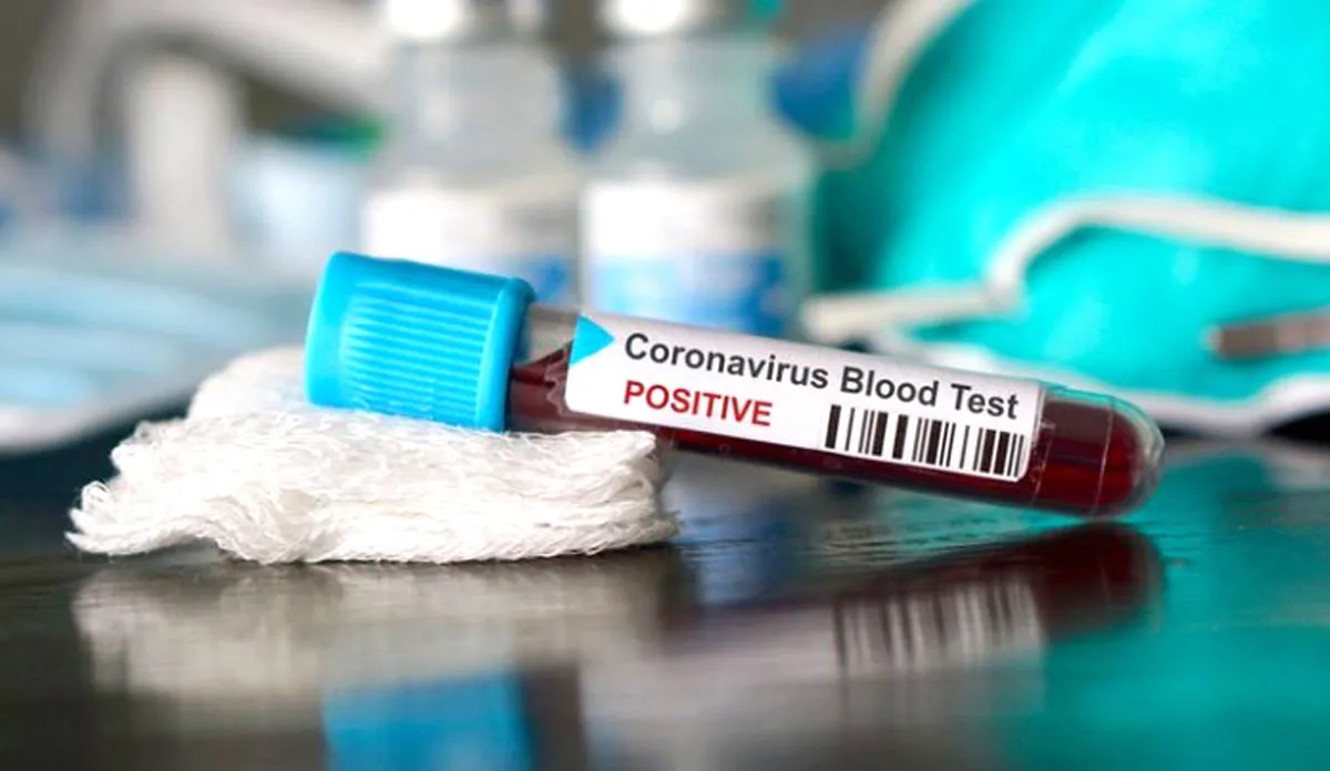 coronavirus latest news- India TV Hindi