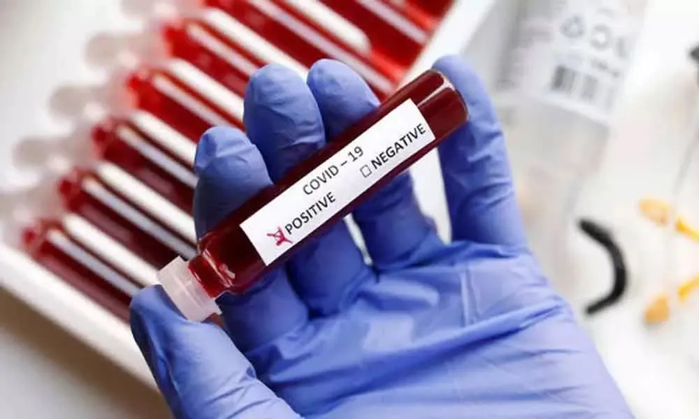 coronavirus cases in Nagpur - India TV Hindi
