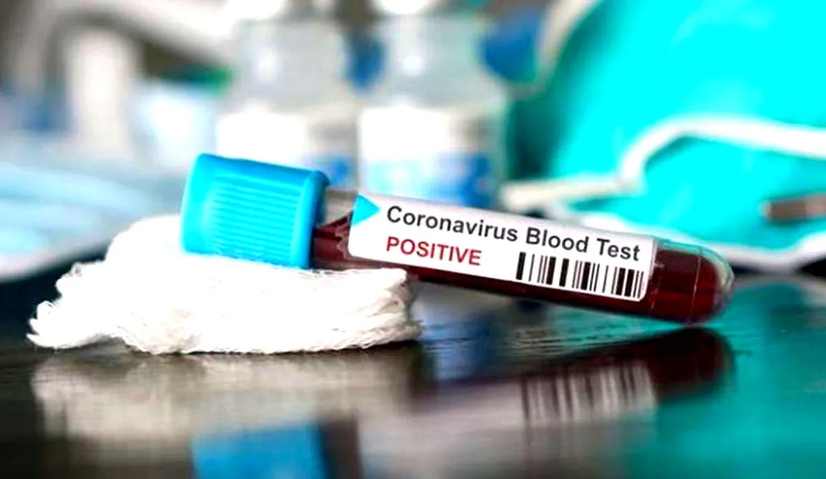 coronavirus- India TV Hindi