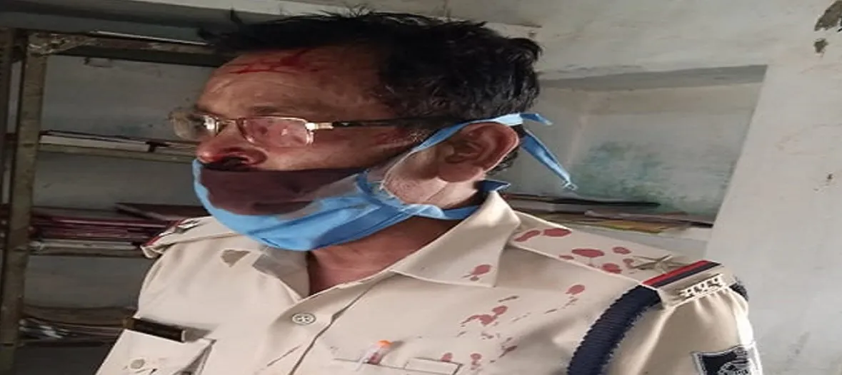 Coronavirus: श्योपुर में पुलिस और मेडिकल टीम पर हमला, एएसआई घायल- India TV Hindi