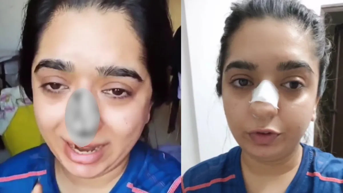 डिलीवरी बॉय ने मुक्का मारकर तोड़ी लड़की की नाक, Zomato ने मांगी माफी- India TV Hindi