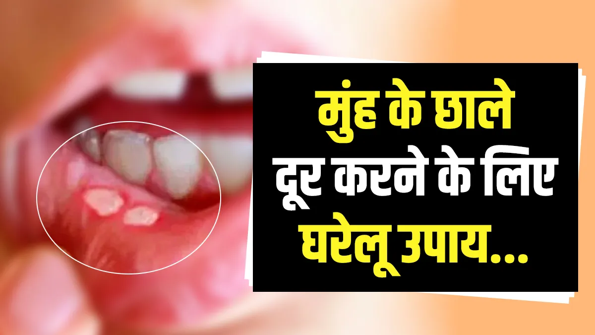 mouth ulcer tips - India TV Hindi