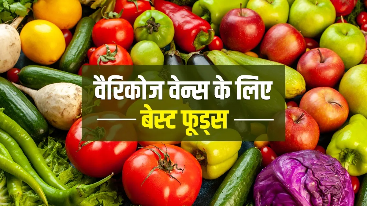 best food to prevent varicose veins varicose veins ke liye food - India TV Hindi