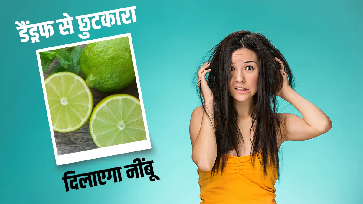 Home remedies for dandruff- India TV Hindi