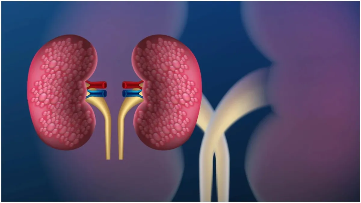 kidney stone infesction swami ramdev- India TV Hindi