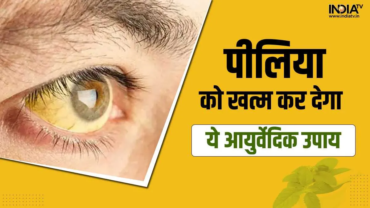 Jaundice Home Remedies Tips- India TV Hindi