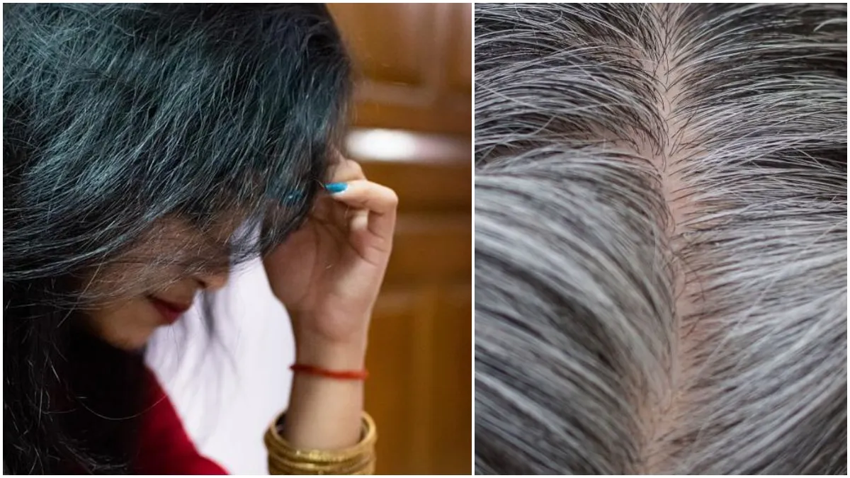 White Hair Problem- India TV Hindi